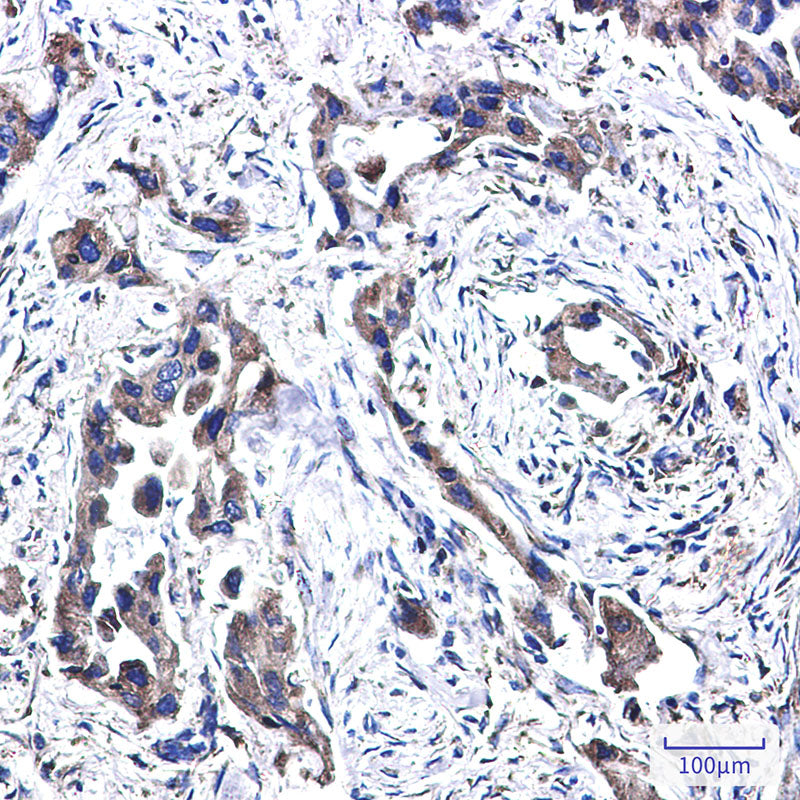 Anti-FADS1 Rabbit Monoclonal Antibody