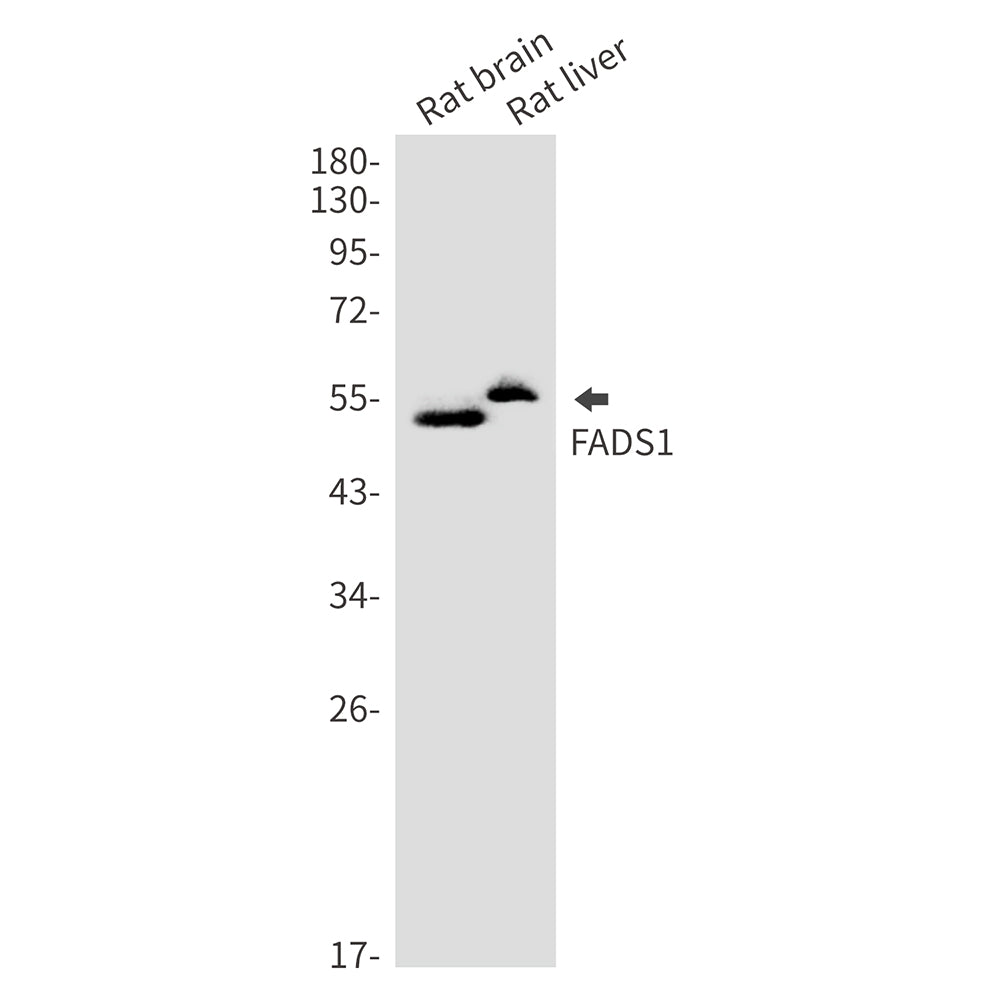 Anti-FADS1 Rabbit Monoclonal Antibody