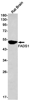 Anti-FADS1 Rabbit Monoclonal Antibody