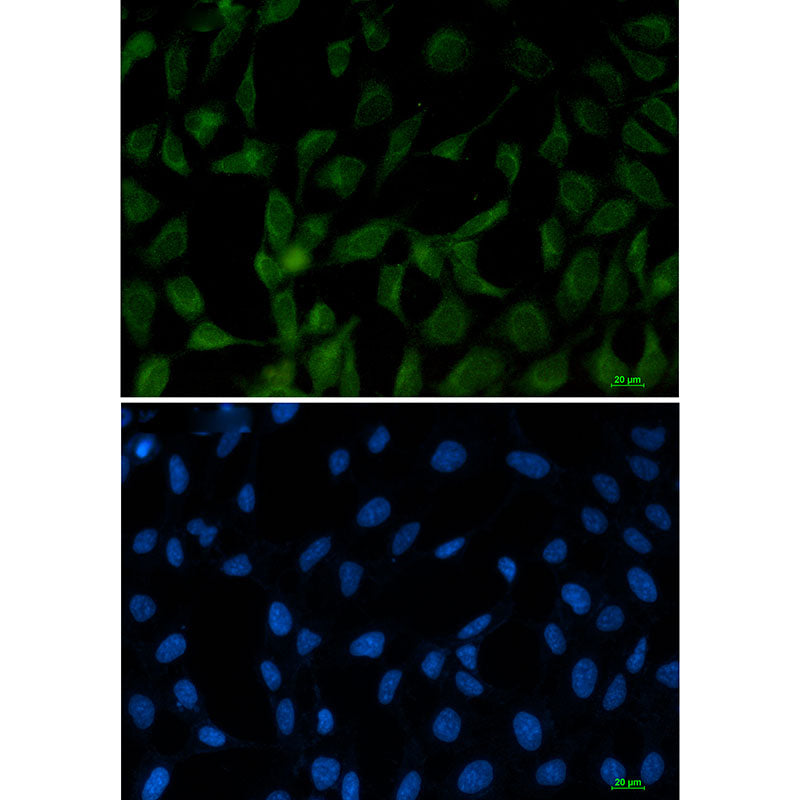 Anti-FE65 Rabbit Monoclonal Antibody