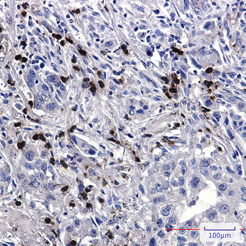 Anti-FE65 Rabbit Monoclonal Antibody
