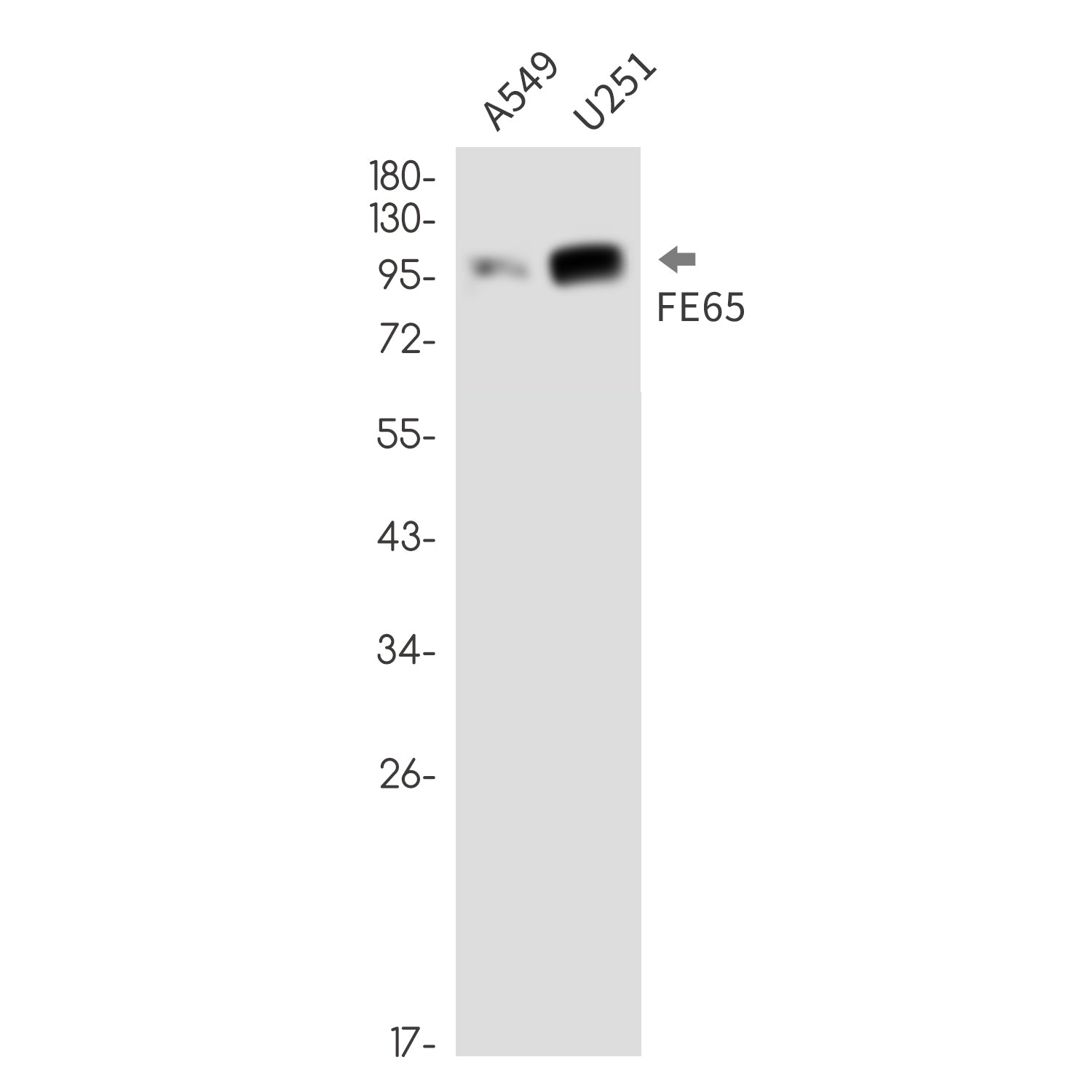 Anti-FE65 Rabbit Monoclonal Antibody