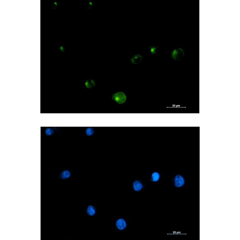 Anti-FGFR1 Oncogene Partner Rabbit Monoclonal Antibody