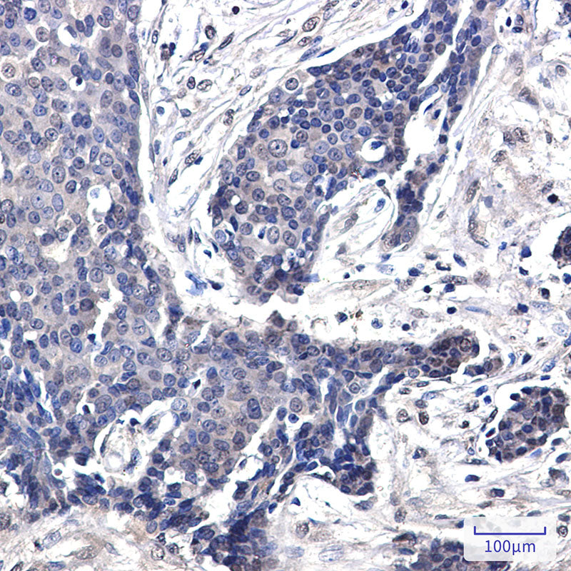 Anti-FHL1 Rabbit Monoclonal Antibody