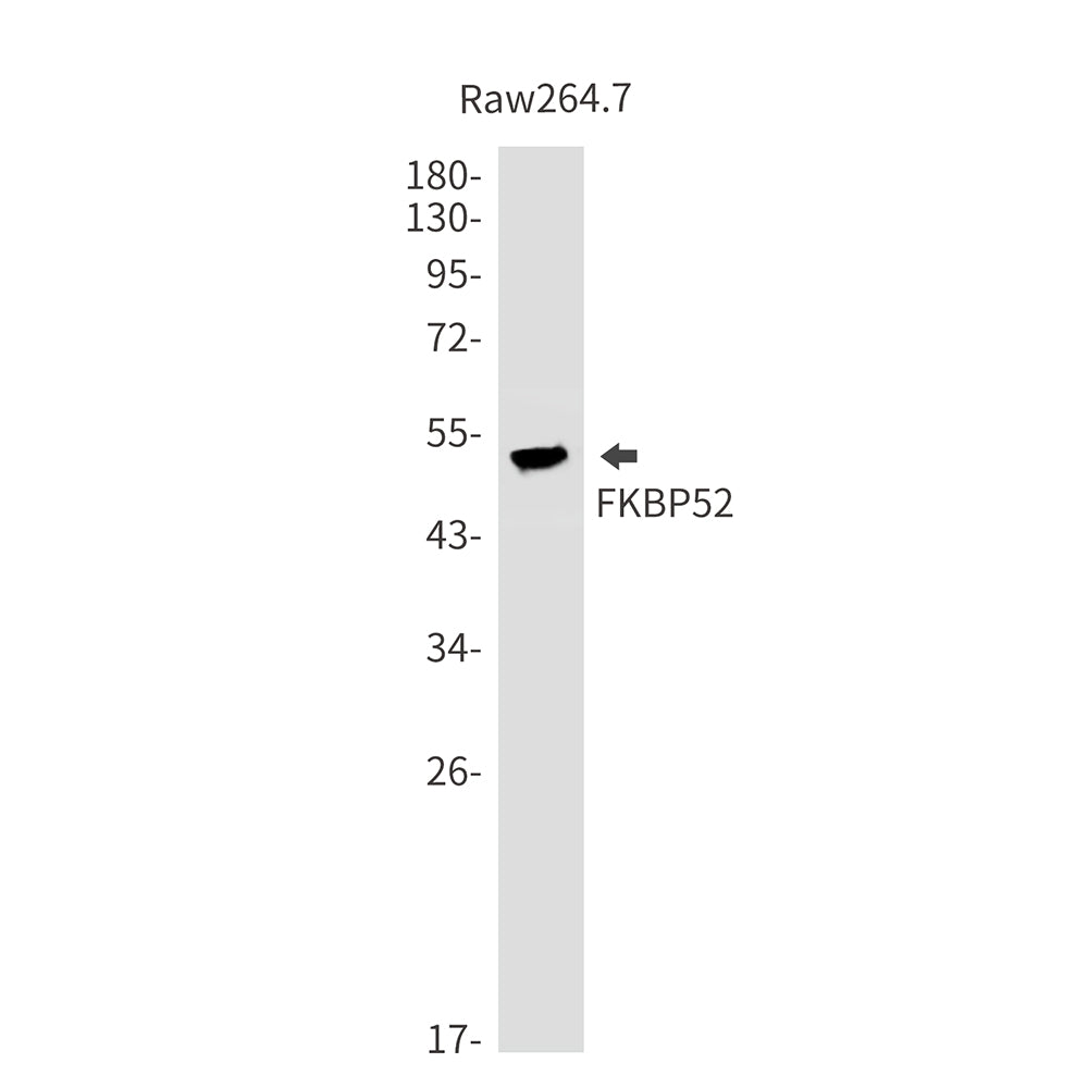 Anti-FKBP52 Rabbit Monoclonal Antibody