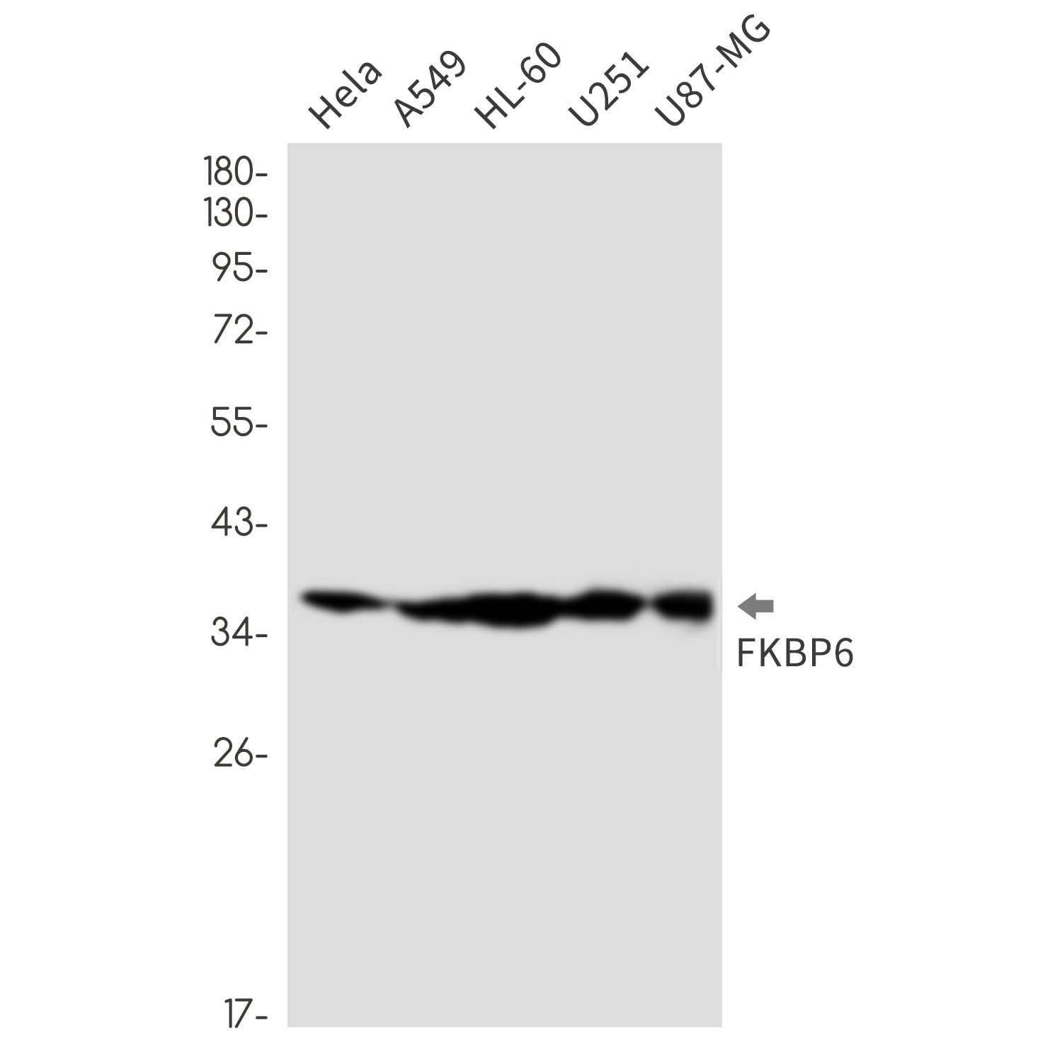 Anti-FKBP6 Rabbit Monoclonal Antibody