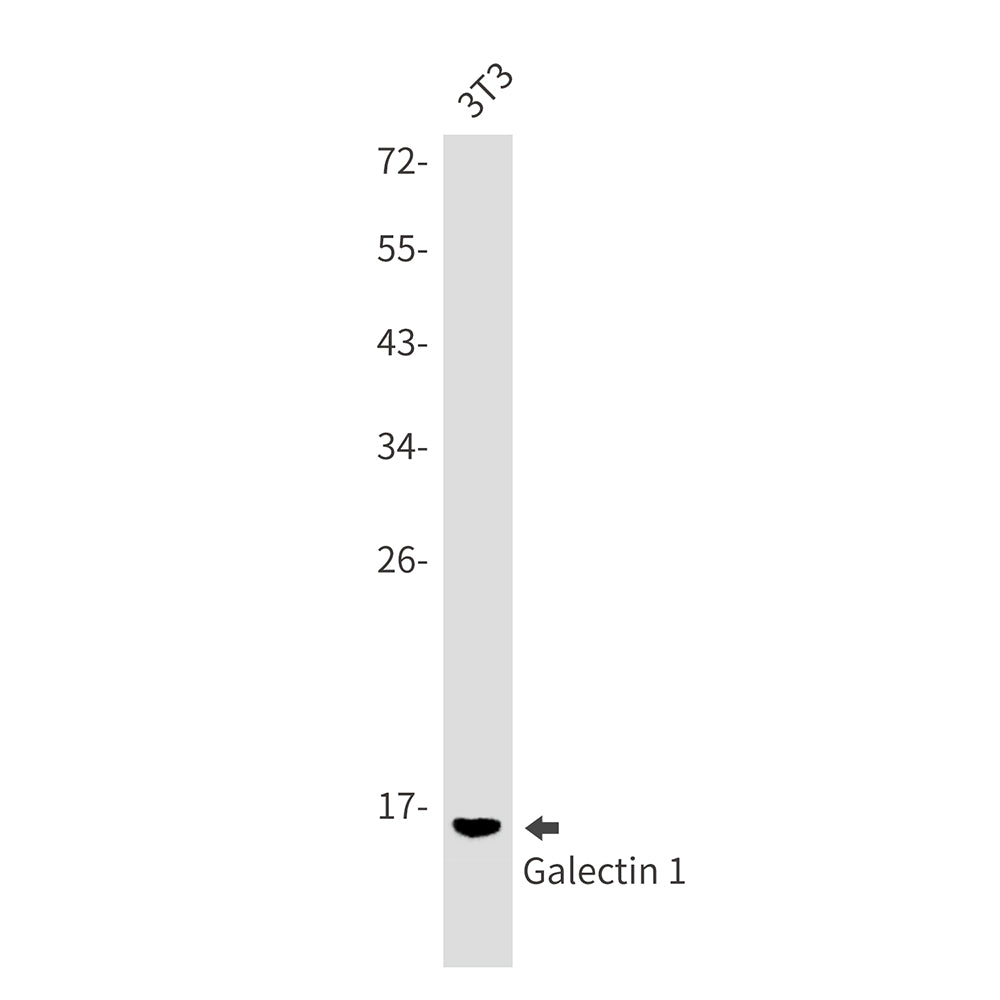 Anti-Galectin 1 Rabbit Monoclonal Antibody