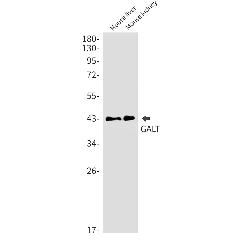 Anti-GALT Rabbit Monoclonal Antibody