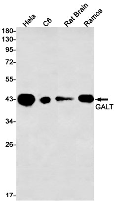 Anti-GALT Rabbit Monoclonal Antibody