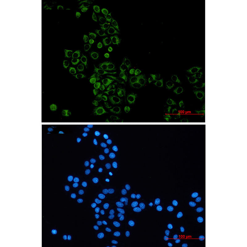 Anti-GBP1 Rabbit Monoclonal Antibody