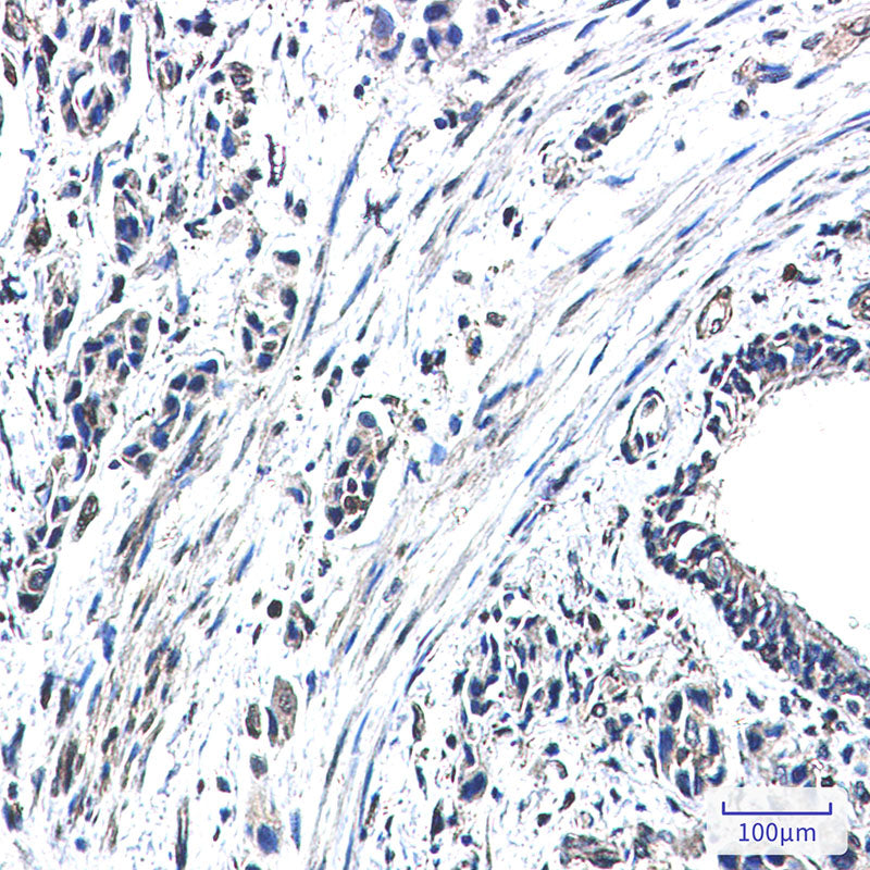 Anti-GBP1 Rabbit Monoclonal Antibody