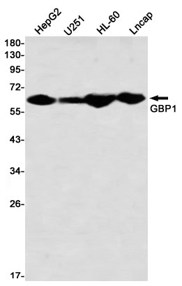 Anti-GBP1 Rabbit Monoclonal Antibody
