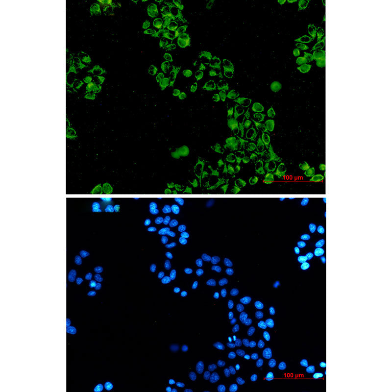 Anti-GC1q R Rabbit Monoclonal Antibody