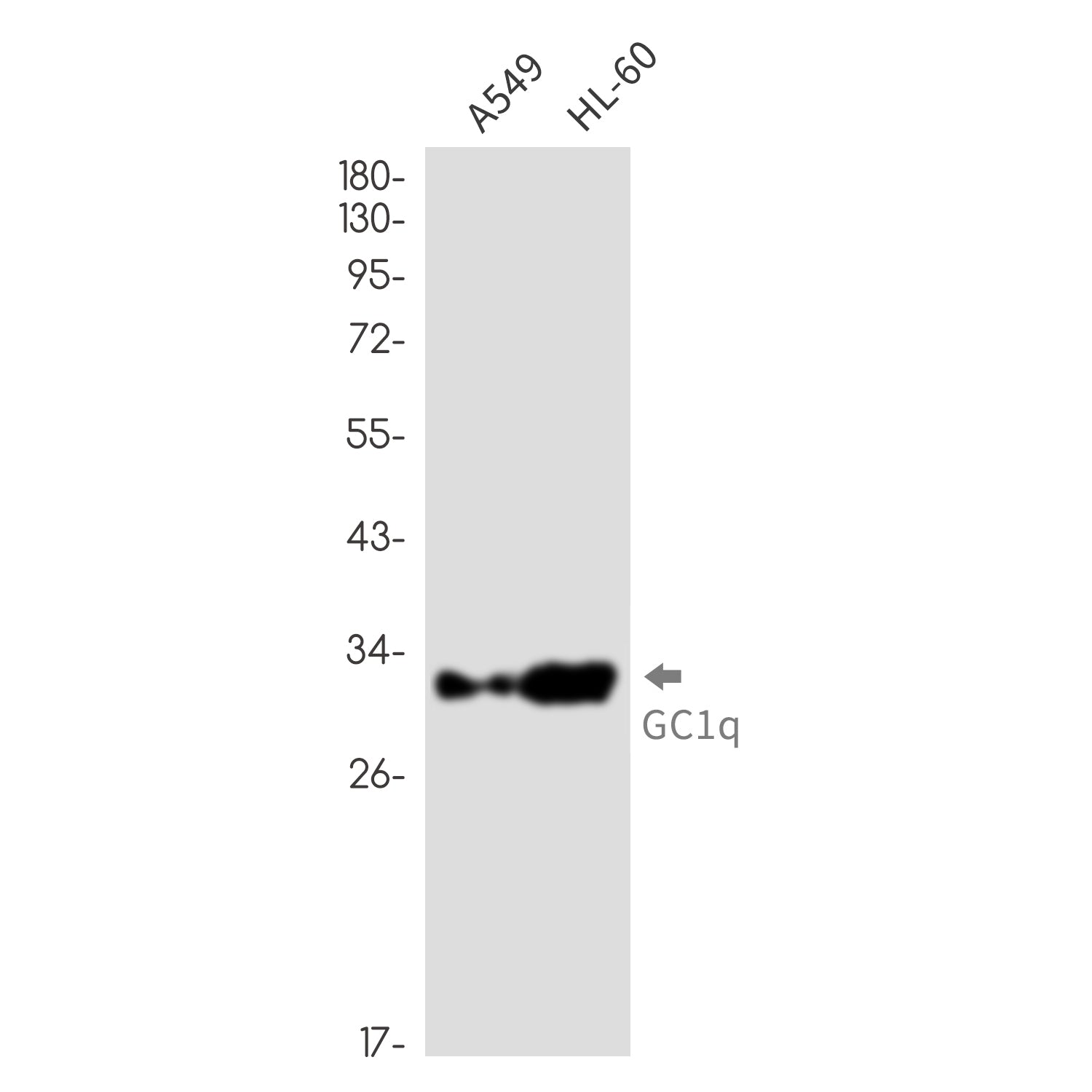 Anti-GC1q R Rabbit Monoclonal Antibody
