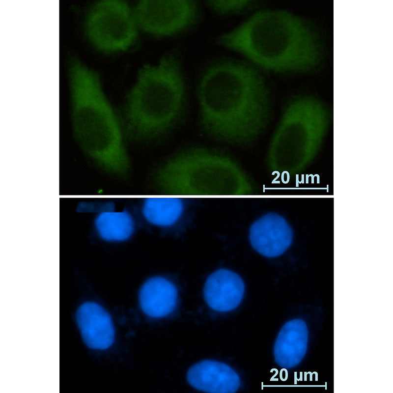 Anti-Glucose 6 Phosphate Dehydrogenase Rabbit Monoclonal Antibody