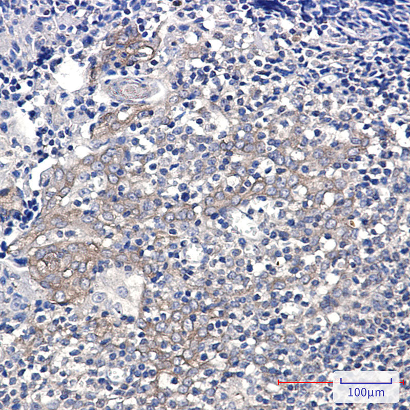 Anti-Glucose 6 Phosphate Dehydrogenase Rabbit Monoclonal Antibody