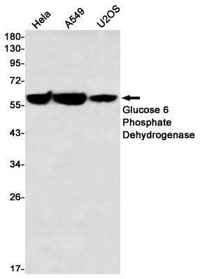 Anti-Glucose 6 Phosphate Dehydrogenase Rabbit Monoclonal Antibody