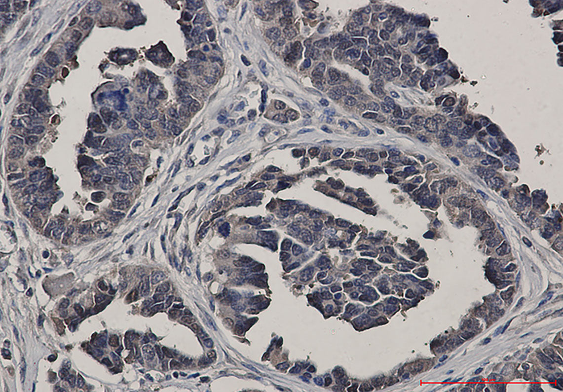 Anti-Glutathione Synthetase Rabbit Monoclonal Antibody