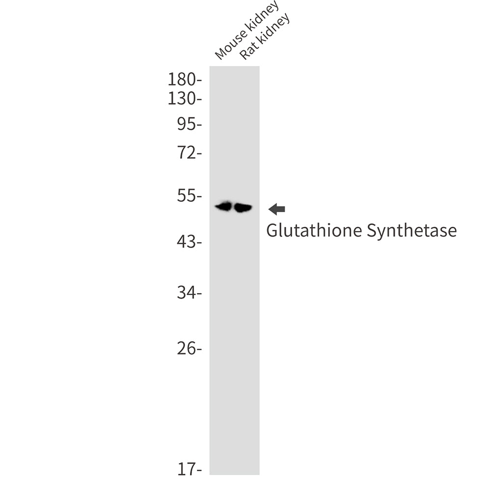 Anti-Glutathione Synthetase Rabbit Monoclonal Antibody