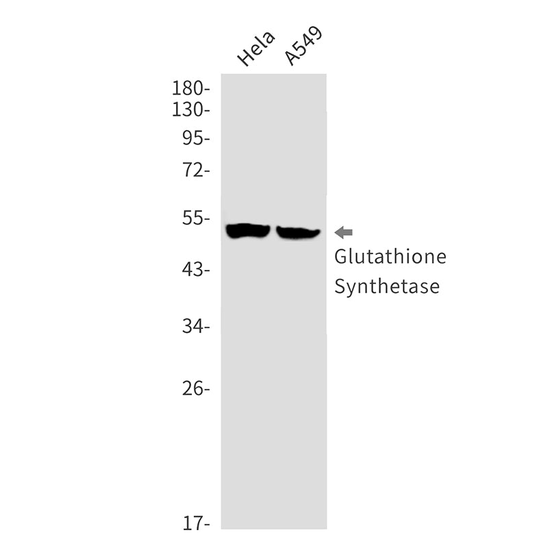 Anti-Glutathione Synthetase Rabbit Monoclonal Antibody