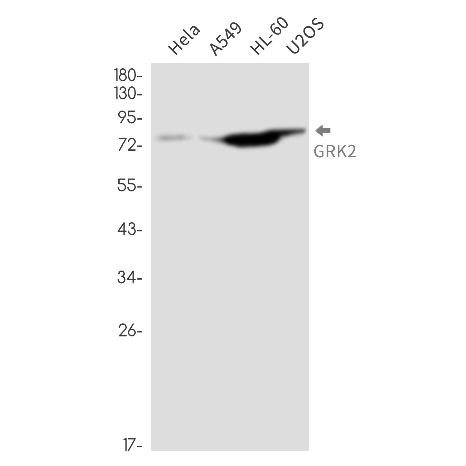 Anti-GRK2 Rabbit Monoclonal Antibody