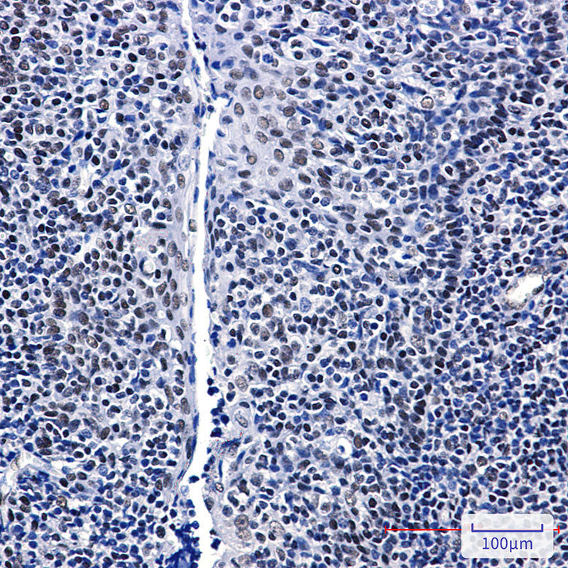 Anti-GTPBP4 Rabbit Monoclonal Antibody