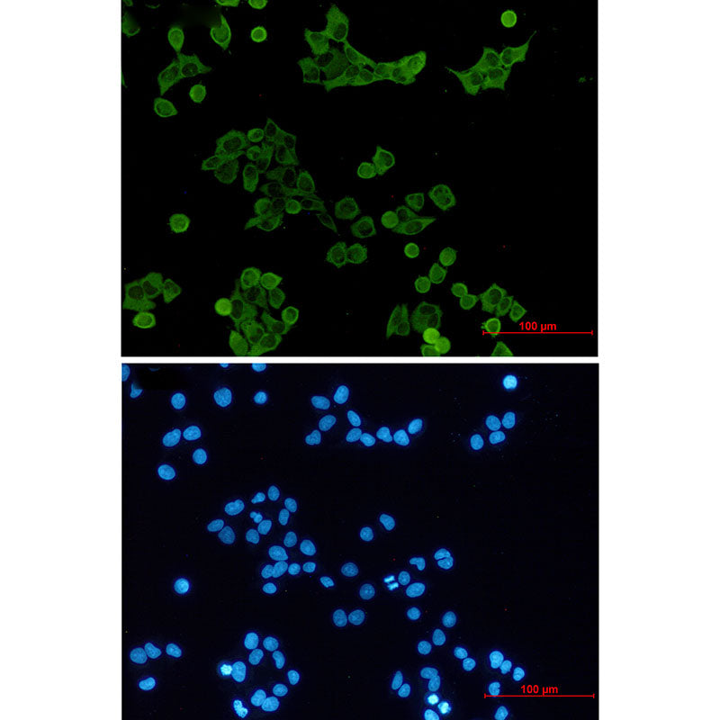 Anti-Tyrosine Protein Kinase HCK Rabbit Monoclonal Antibody