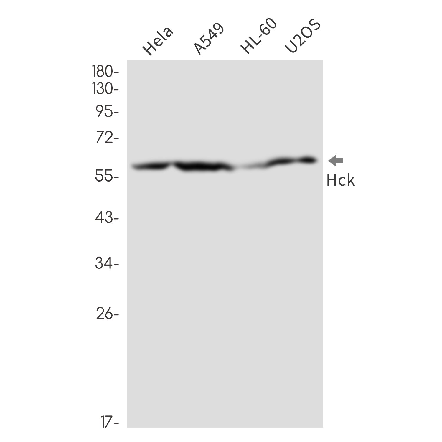 Anti-Tyrosine Protein Kinase HCK Rabbit Monoclonal Antibody