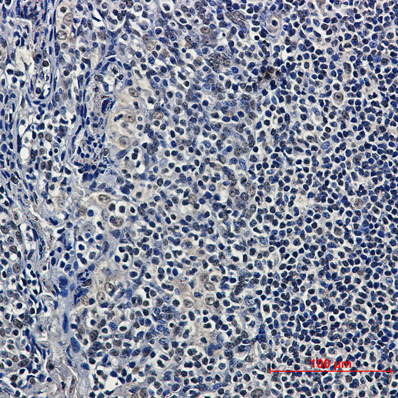 Anti-HDAC9 Rabbit Monoclonal Antibody