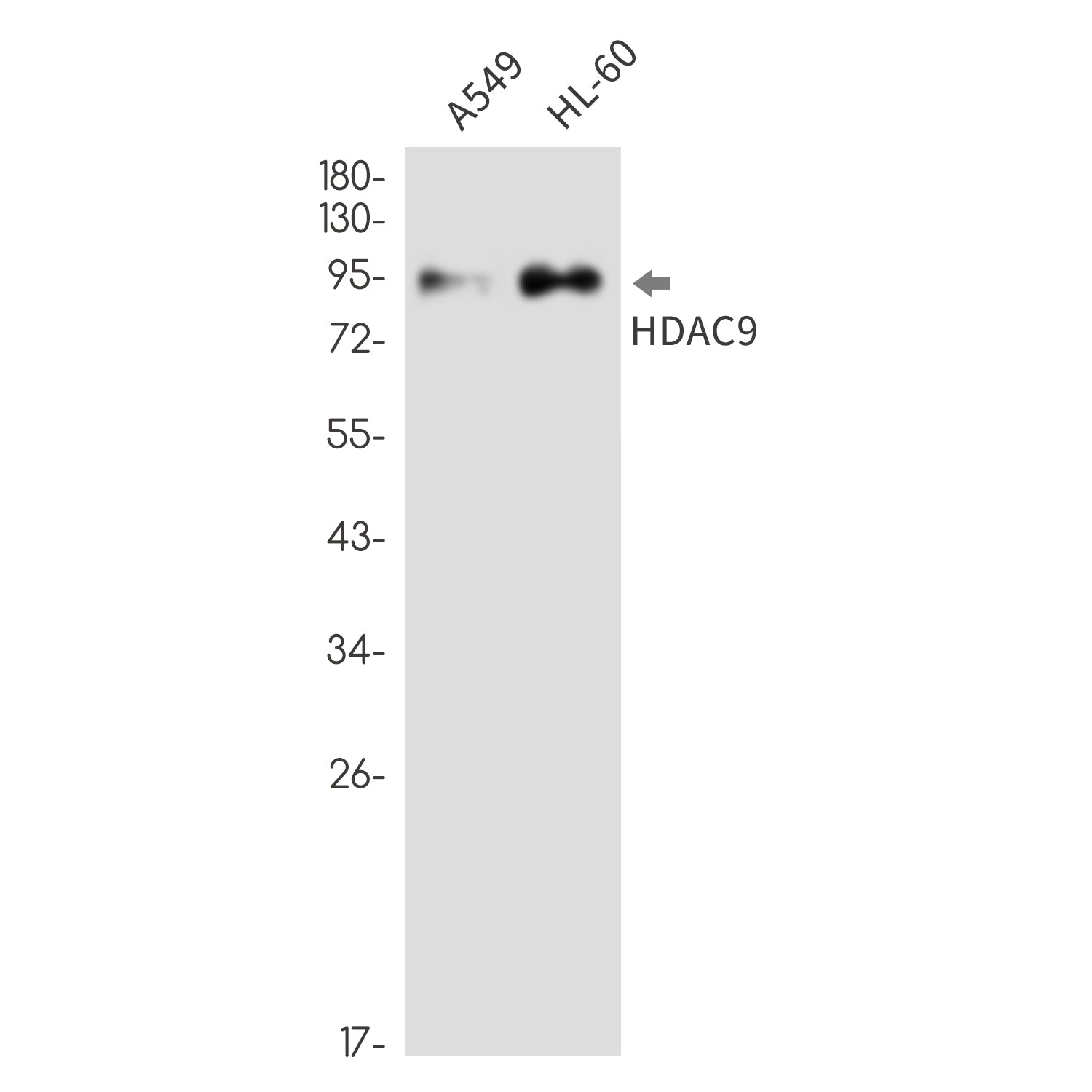Anti-HDAC9 Rabbit Monoclonal Antibody