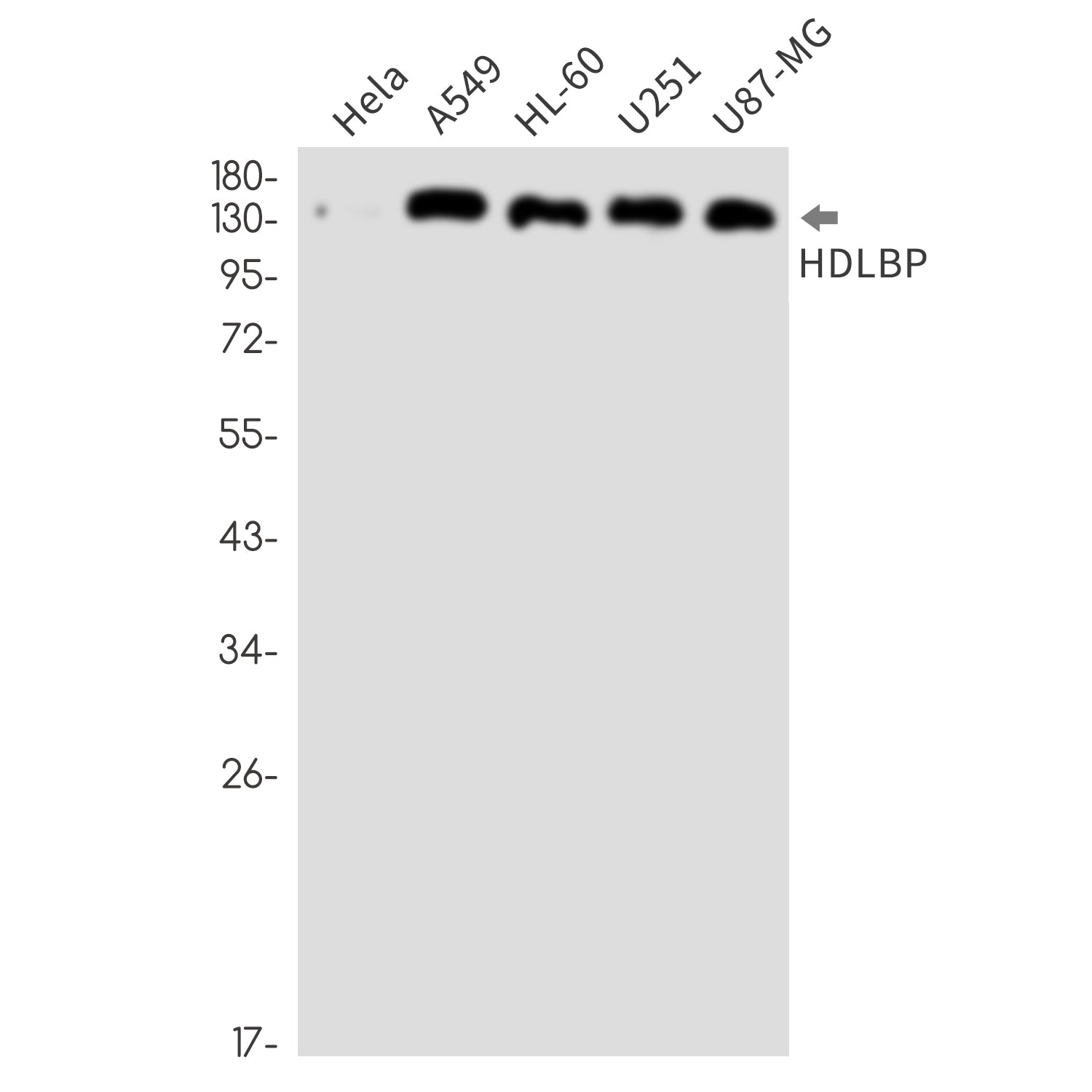 Anti-HDLBP Rabbit Monoclonal Antibody