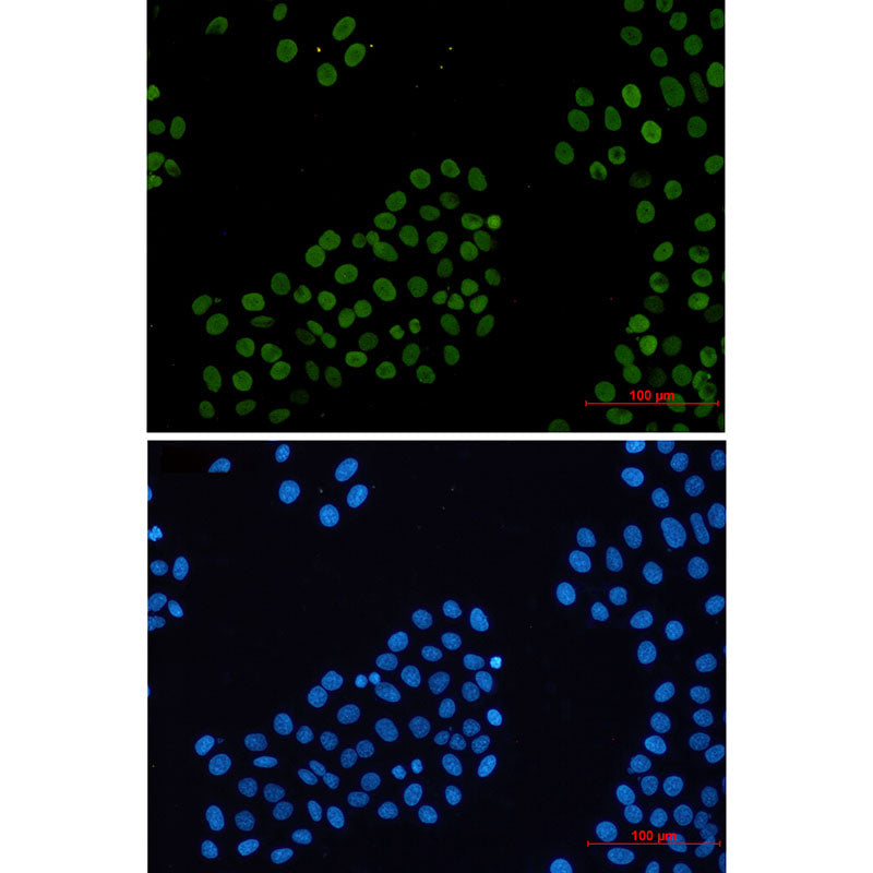 Anti-Histone H2A.X Rabbit Monoclonal Antibody