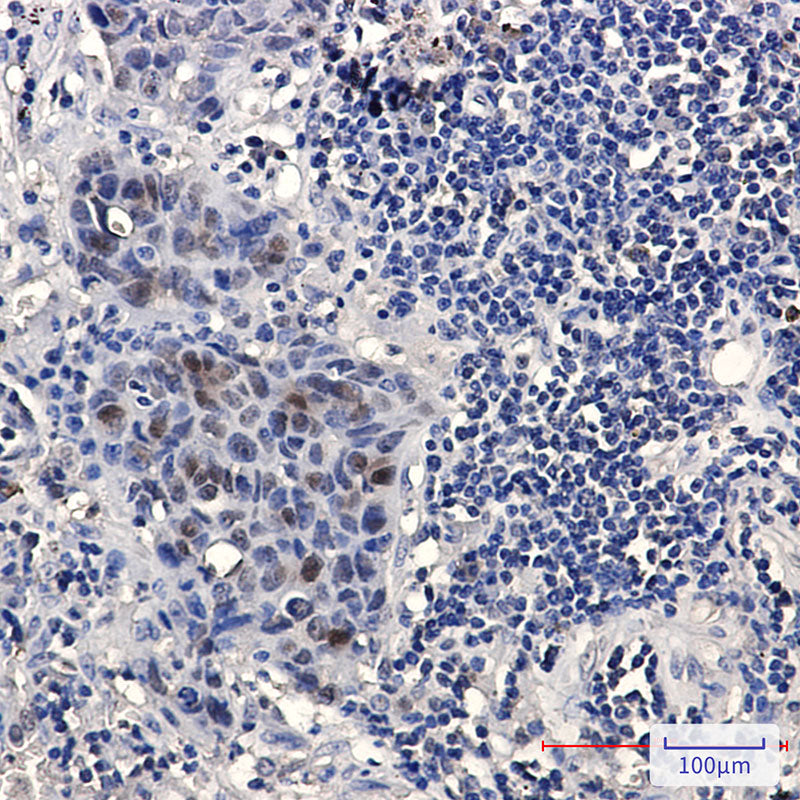 Anti-HMG4 Rabbit Monoclonal Antibody
