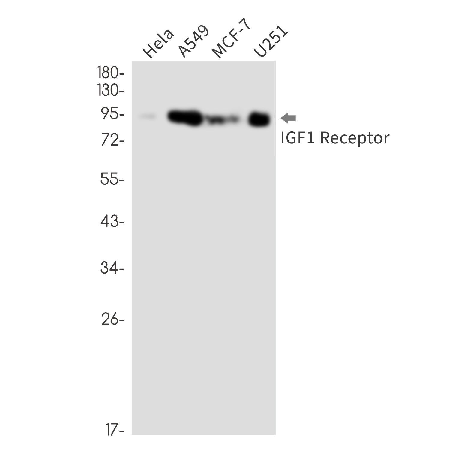 Anti-IGF1 Receptor Rabbit Monoclonal Antibody