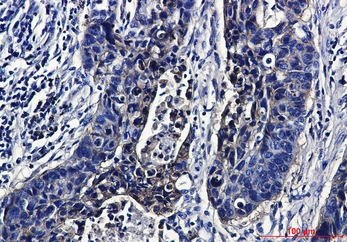 Anti-IGF1 Receptor Rabbit Monoclonal Antibody