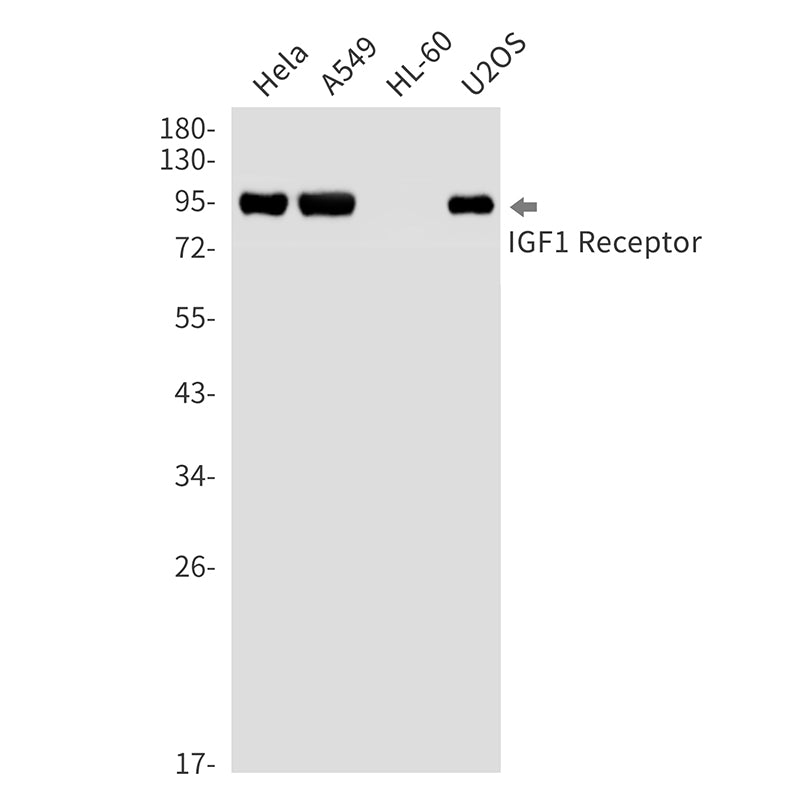 Anti-IGF1 Receptor Rabbit Monoclonal Antibody