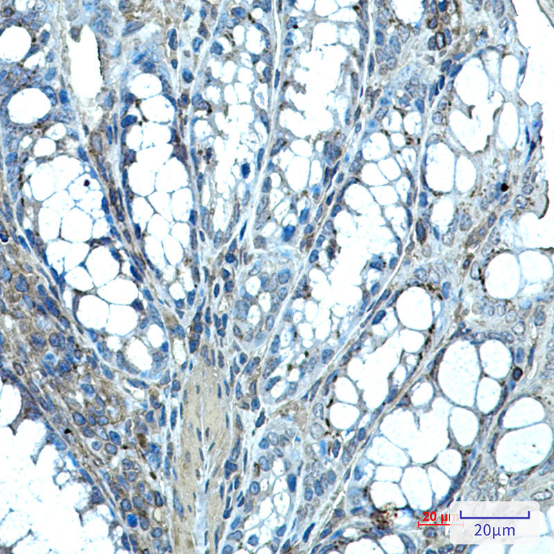 Anti-Ihh Rabbit Monoclonal Antibody