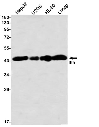 Anti-Ihh Rabbit Monoclonal Antibody
