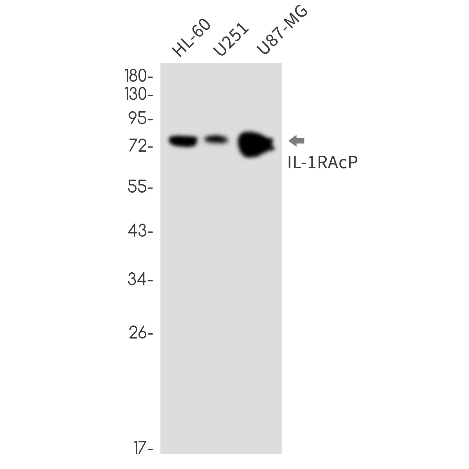 Anti-IL-1 Receptor Accessory Protein Rabbit Monoclonal Antibody