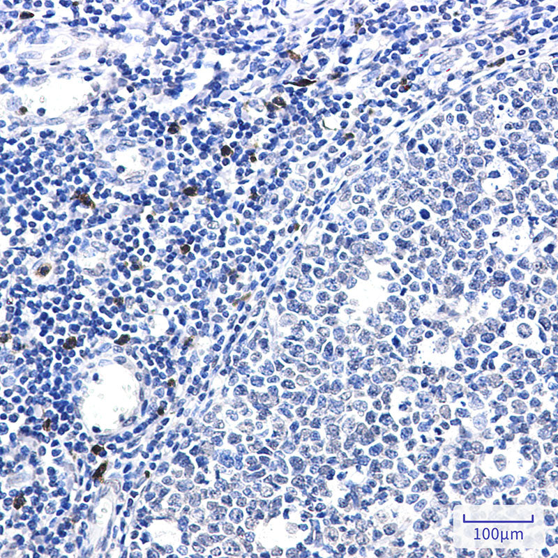 Anti-IL-26 Rabbit Monoclonal Antibody