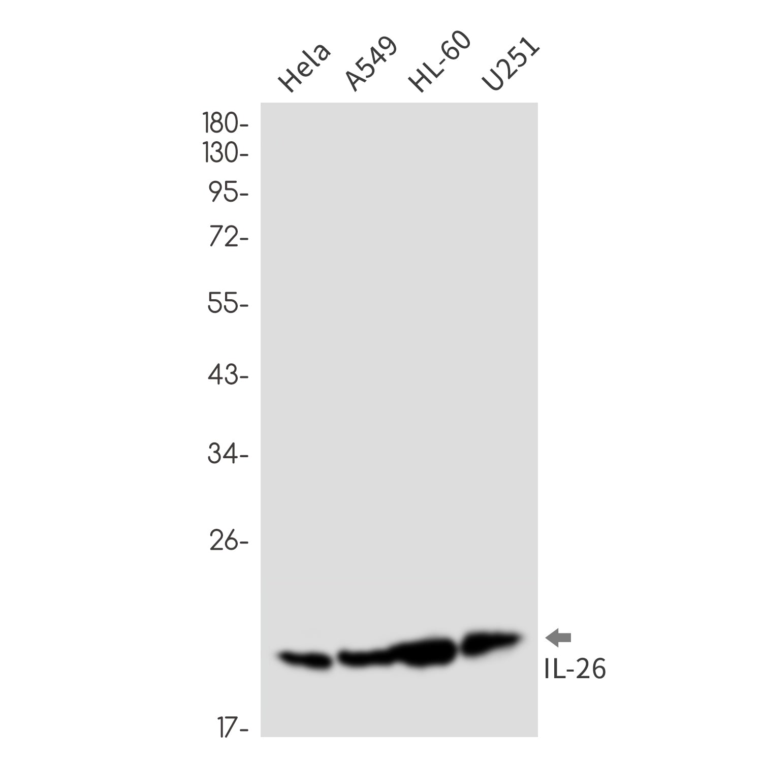 Anti-IL-26 Rabbit Monoclonal Antibody