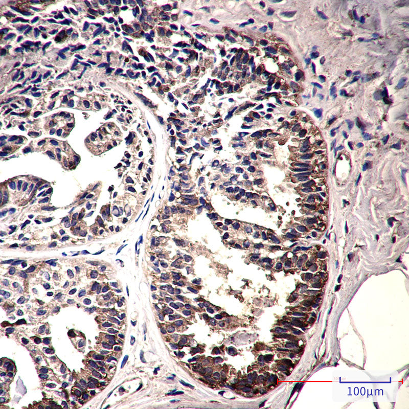 Anti-IMPDH2 Rabbit Monoclonal Antibody