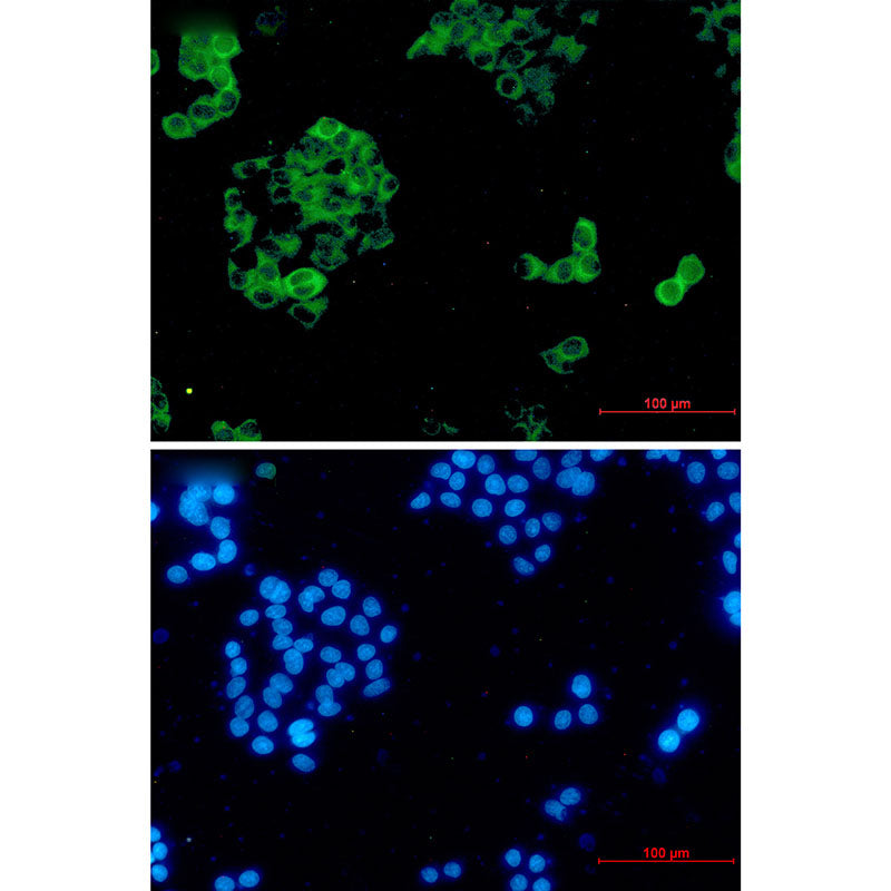 Anti-Insulin Degrading Enzyme Rabbit Monoclonal Antibody
