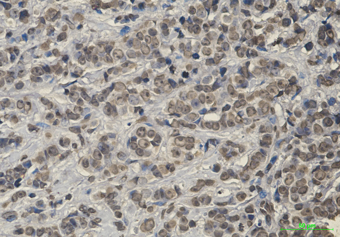 Anti-Keap1 Rabbit Monoclonal Antibody