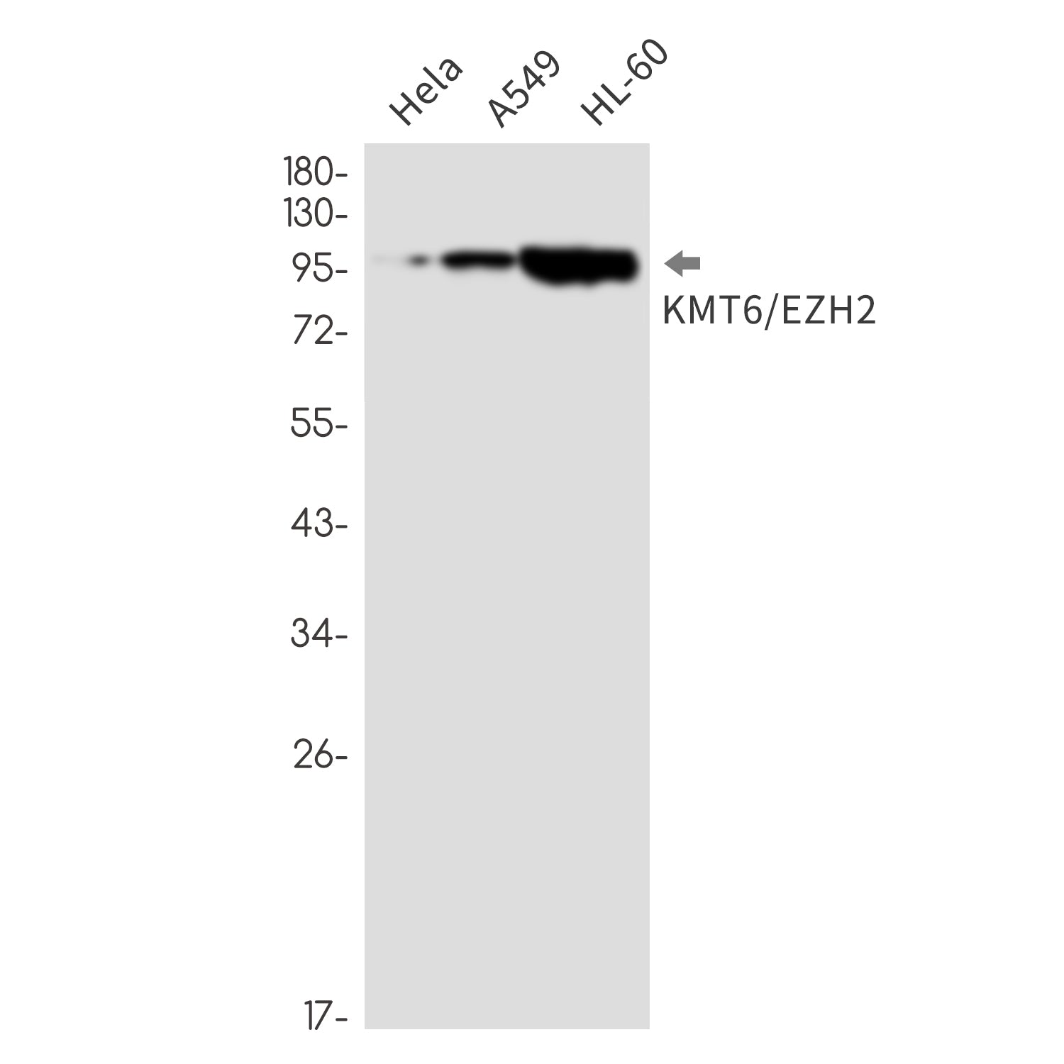 Anti-KMT6 Rabbit Monoclonal Antibody