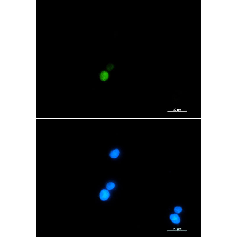 Anti-Ku70 Rabbit Monoclonal Antibody