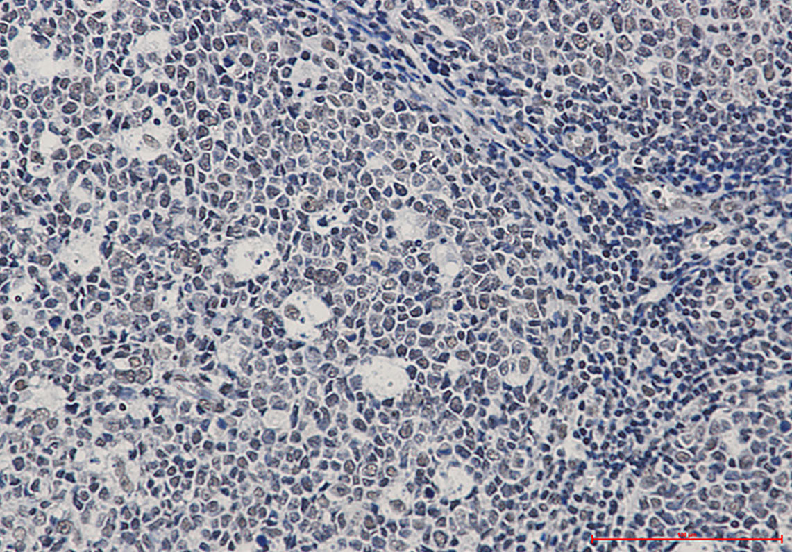 Anti-Ku70 Rabbit Monoclonal Antibody