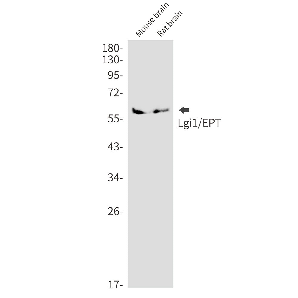 Anti-LGI1 Rabbit Monoclonal Antibody
