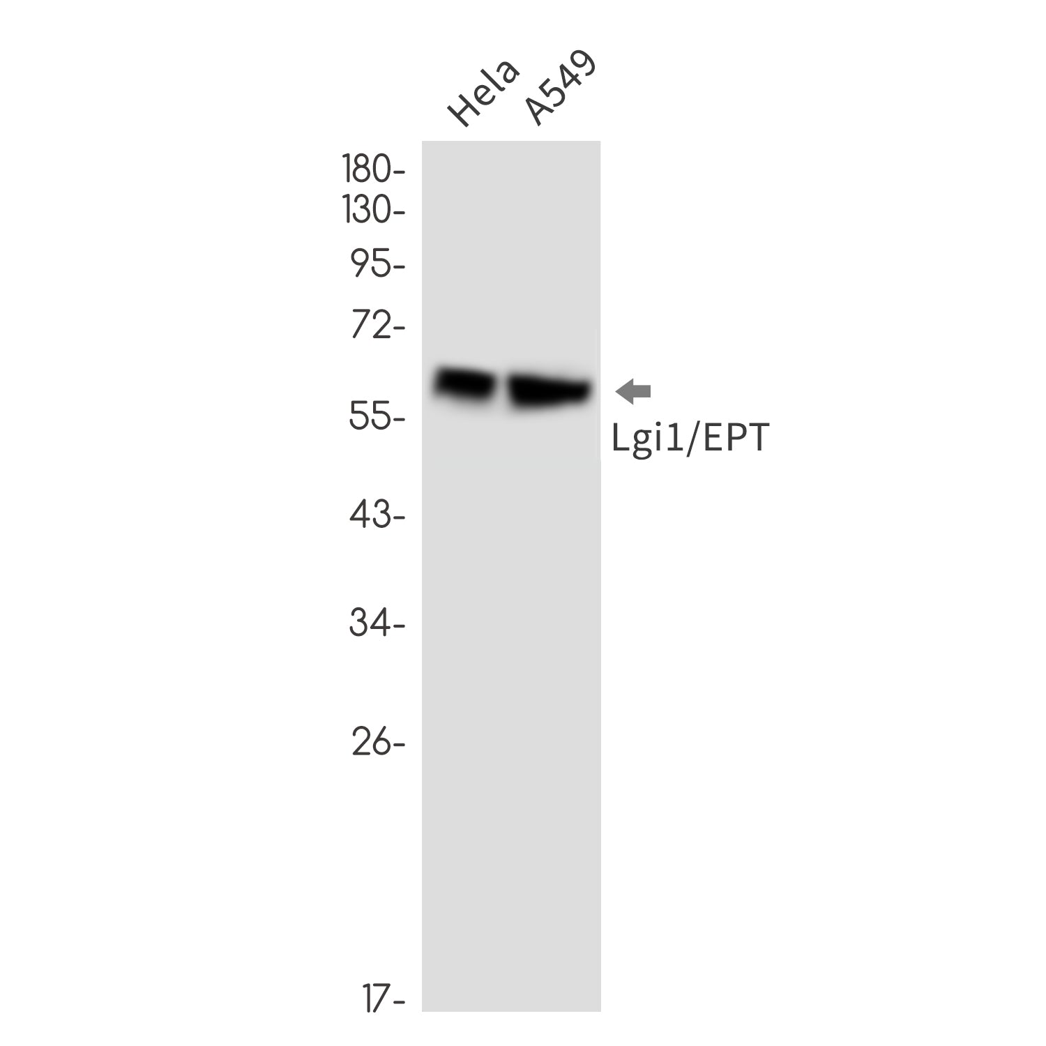 Anti-LGI1 Rabbit Monoclonal Antibody