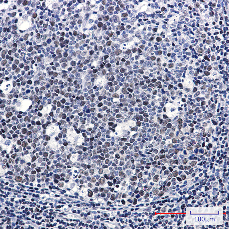 Anti-LIG1 Rabbit Monoclonal Antibody